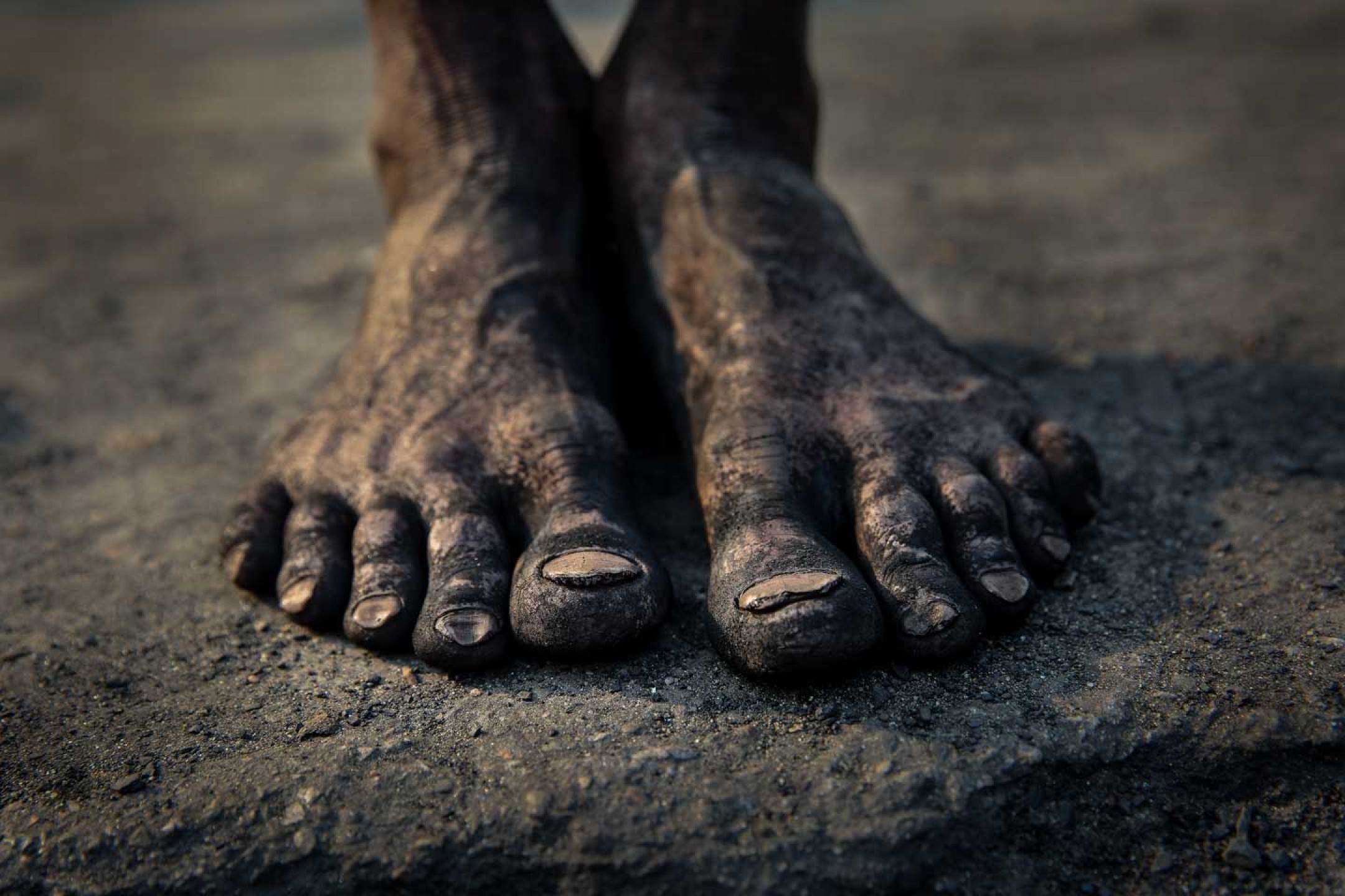 Feet tells stories.